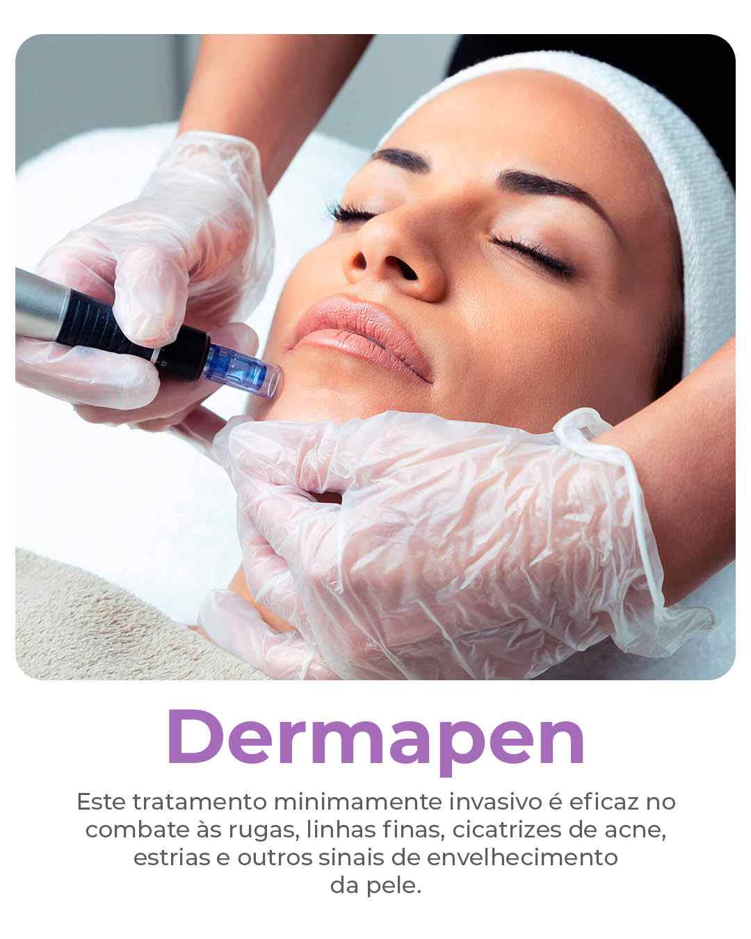 Dermapen-compressed (1)