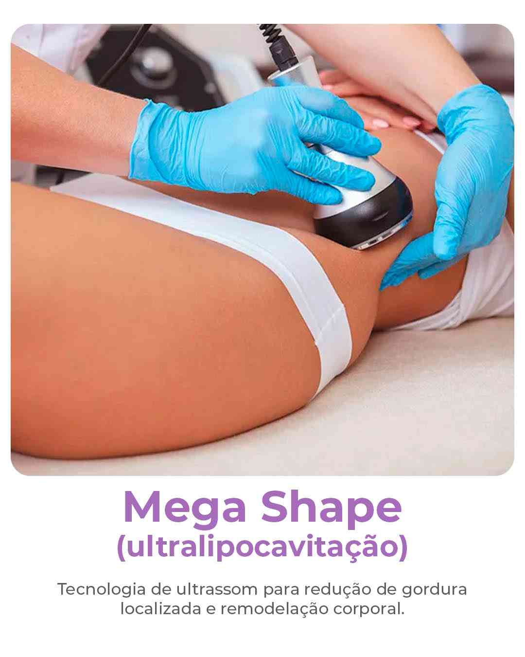Mega shape-compressed