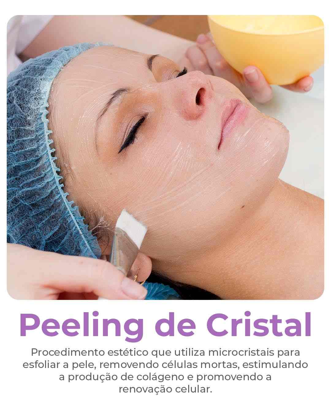 Peeling de cristal-compressed
