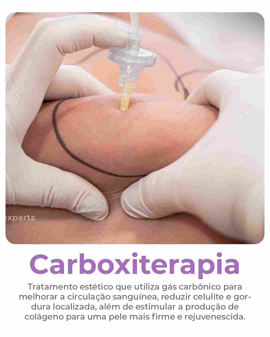 carboxiterapia-compressed